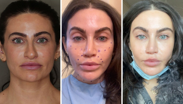 Image may contain Face Head Person Photography Portrait and Adult